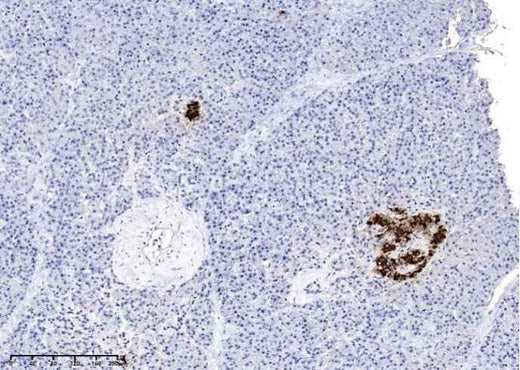 Anti-Human INS Antibody [A1162] - ABMIUM