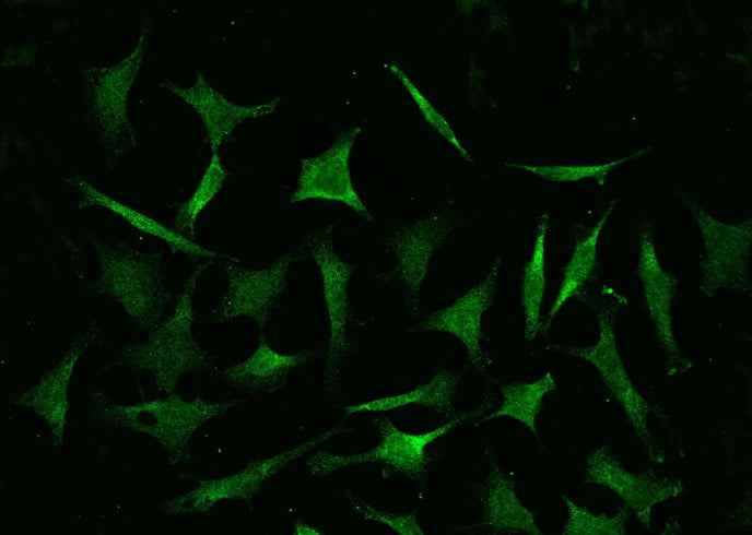 Anti-Human COMMD9 Antibody [A1095] - ABMIUM
