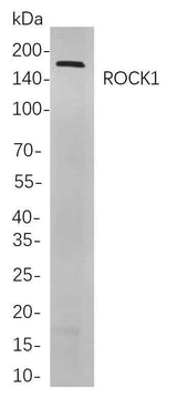 Anti-Human/Mouse/Rat ROCK1 Antibody [B752]