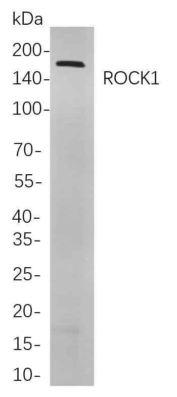 Anti-Human/Mouse/Rat ROCK1 Antibody [B752]