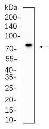Anti-Human/Mouse/Rat MX1 Antibody [B567]
