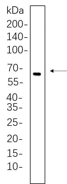 Anti-Human/Mouse/Rat Estrogen Receptor α Antibody [B673] - ABMIUM