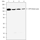 Anti-Human/Rat/Mouse ATP Citrate Lyase Antibody [A772] - ABMIUM