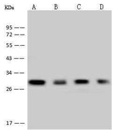 Anti-Human CTLA4 Antibody [A1060] - ABMIUM