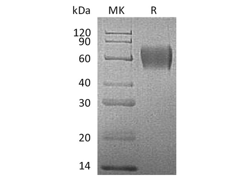 Recombinant Human IL17RA Protein (His Tag) - ABMIUM