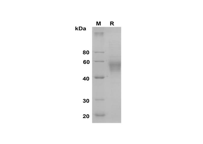 SDS-PAGE analysis of Mouse Selenoprotein P/SEPP1 proteins, 2 μg/lane of Recombinant Mouse Selenoprotein P/SEPP1 proteins was resolved with SDS-PAGE under reducing conditions, showing bands at 50-60 kDa.