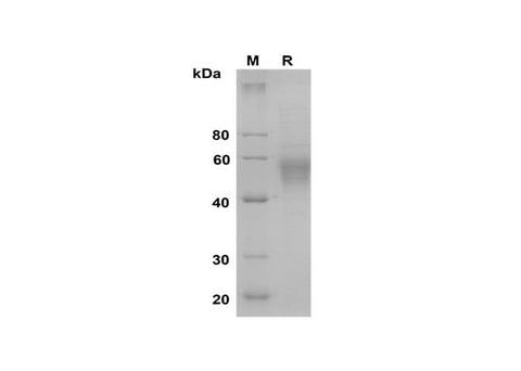 SDS-PAGE analysis of Mouse Selenoprotein P/SEPP1 proteins, 2 μg/lane of Recombinant Mouse Selenoprotein P/SEPP1 proteins was resolved with SDS-PAGE under reducing conditions, showing bands at 50-60 kDa.