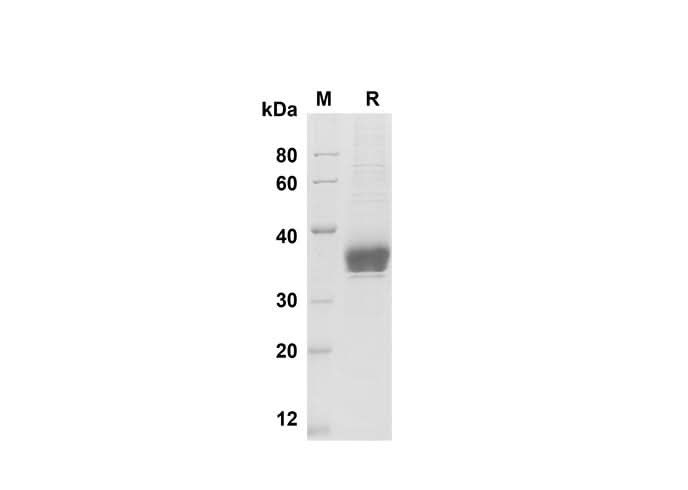 SDS-PAGE analysis of Human EpCAM/TROP-1 proteins , 2 μg/lane of Recombinant Human EpCAM/TROP-1 proteins was resolved with SDS-PAGE under reducing conditions , showing bands at 35 kDa.