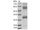 Recombinant EBOV (subtype Zaire, strain H.sapiens-wt/GIN/2014/Kissidougou-C15) Glycoprotein / GP (Virion spike glycoprotein) Protein (His Tag) - ABMIUM