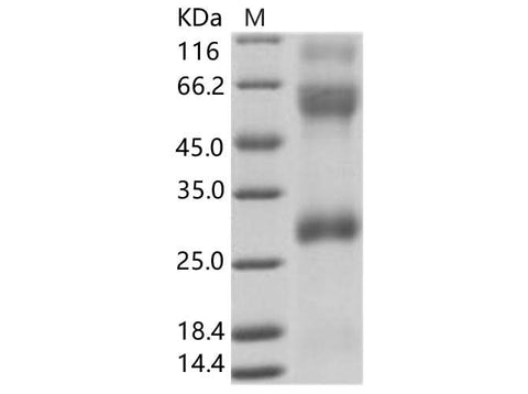 Recombinant EBOV (subtype Zaire, strain H.sapiens-wt/GIN/2014/Kissidougou-C15) Glycoprotein / GP (Virion spike glycoprotein) Protein (His Tag) - ABMIUM