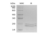 SDS-PAGE analysis of Human MCEE proteins, 2 μg/lane of Recombinant Human MCEE proteins was resolved with SDS-PAGE under reducing conditions, showing bands at 18-20 kDa.
