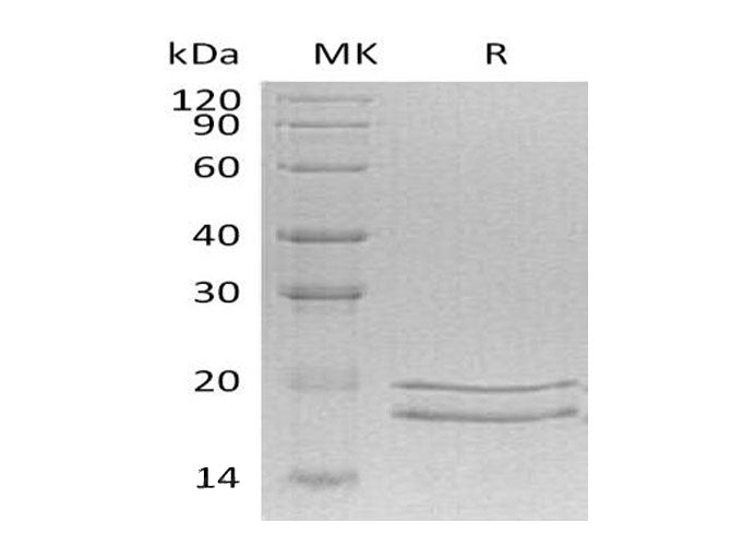 SDS-PAGE analysis of Human MCEE proteins, 2 μg/lane of Recombinant Human MCEE proteins was resolved with SDS-PAGE under reducing conditions, showing bands at 18-20 kDa.