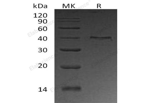 Recombinant Human UPRT Protein (His Tag) - ABMIUM