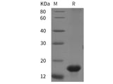 SDS-PAGE analysis of Rat CD47 proteins, 2 μg/lane of Recombinant Rat CD47 proteins was resolved with SDS-PAGE under reducing conditions, showing bands at 15 kDa.