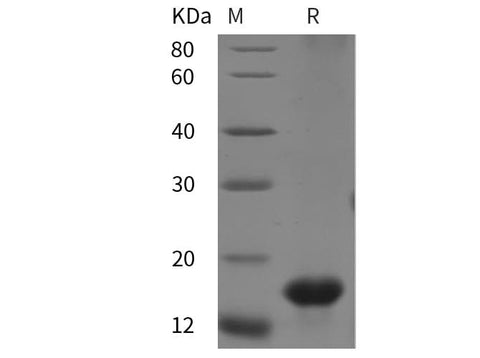 SDS-PAGE analysis of Rat CD47 proteins, 2 μg/lane of Recombinant Rat CD47 proteins was resolved with SDS-PAGE under reducing conditions, showing bands at 15 kDa.