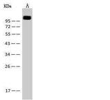 Anti-Mouse MCAM Antibody [B491]