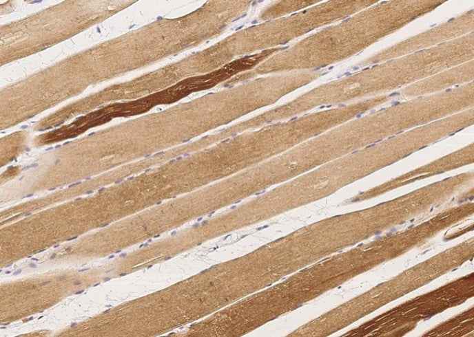 Anti-Human MAPKAPK3 Antibody [A920] - ABMIUM