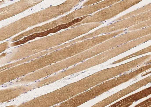 Anti-Human MAPKAPK3 Antibody [A920] - ABMIUM