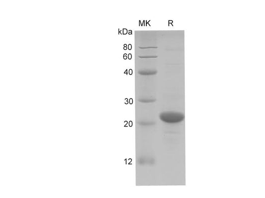 SDS-PAGE analysis of Human FGF14 Isoform 1B proteins, 2 μg/lane of Recombinant Human FGF14 Isoform 1B proteins was resolved with SDS-PAGE under reducing conditions, showing bands at 22 kDa.