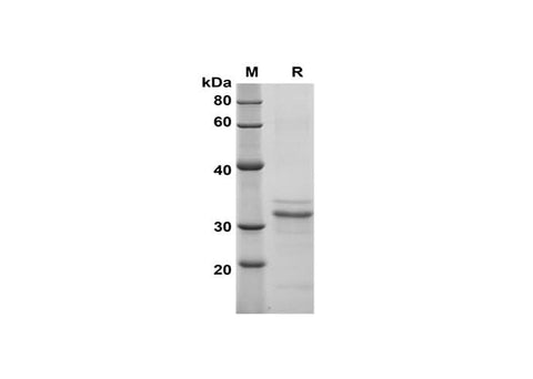 SDS-PAGE analysis of Mouse Endoglin/CD105 proteins, 2 μg/lane of Recombinant Mouse Endoglin/CD105 proteins was resolved with SDS-PAGE under reducing conditions, showing bands at 32 kDa.