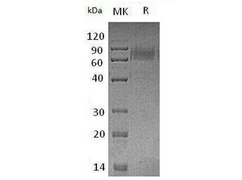 Recombinant Mouse TYRO3/DTK Protein (mFc Tag) - ABMIUM