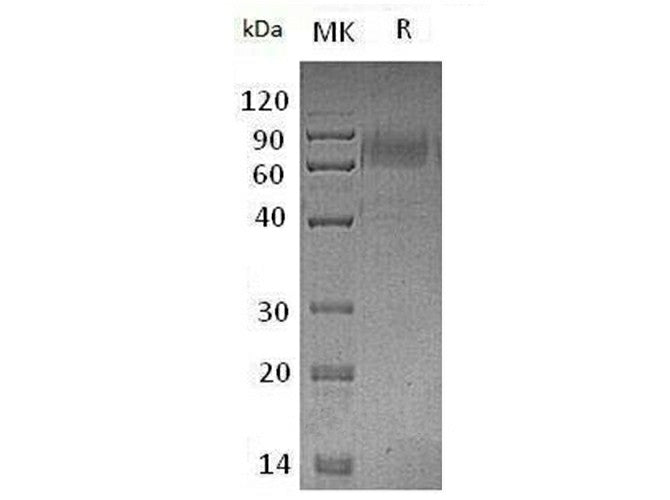 Recombinant Mouse TYRO3/DTK Protein (mFc Tag) - ABMIUM