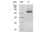 Recombinant Human HMBS Protein (His Tag) - ABMIUM
