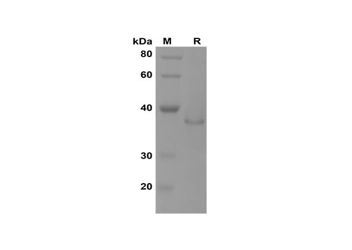 SDS-PAGE analysis of Human IGF-1 proteins, 2 μg/lane of Recombinant Human IGF-1 proteins was resolved with SDS-PAGE under reducing conditions, showing bands at 38 kDa.