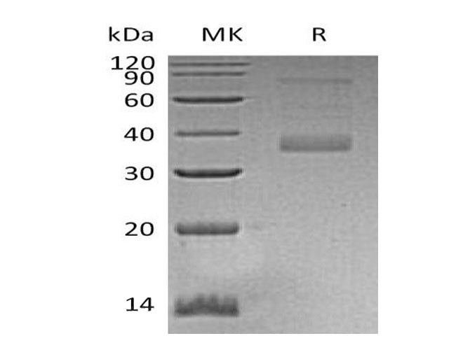> 85 % as determined by reducing SDS-PAGE.