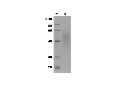 SDS-PAGE analysis of Mouse IL-2RA proteins, 2 μg/lane of Recombinant Mouse IL-2RA proteins was resolved with SDS-PAGE under reducing conditions, showing bands at 35-60 kDa.