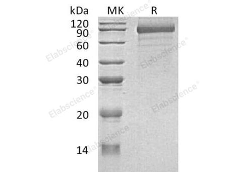 Recombinant Human Cadherin-8/CDH8 Protein (His Tag) - ABMIUM