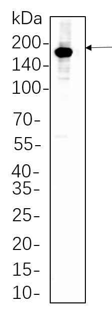 Anti-Human/Mouse/Rat HER2 Antibody [B669] - ABMIUM