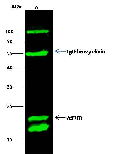 Anti-Human ASF1B Antibody [B378] - ABMIUM