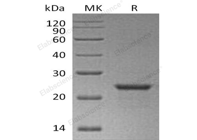 Recombinant Human NEDD8 Protein (His Tag, SUMO Tag) - ABMIUM