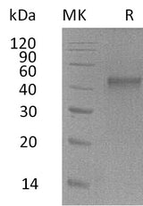 Recombinant Mouse ST6GALNAC2 Protein (His Tag) - ABMIUM