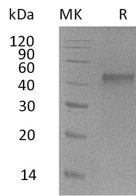 Recombinant Mouse ST6GALNAC2 Protein (His Tag) - ABMIUM
