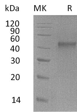 Recombinant Mouse ST6GALNAC2 Protein (His Tag) - ABMIUM