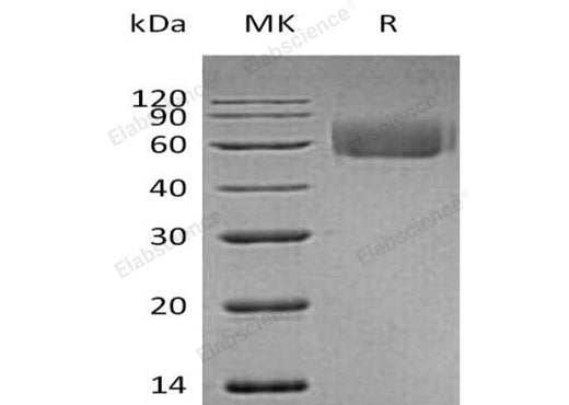 Recombinant Human IL-1RL2 Protein (His Tag) - ABMIUM
