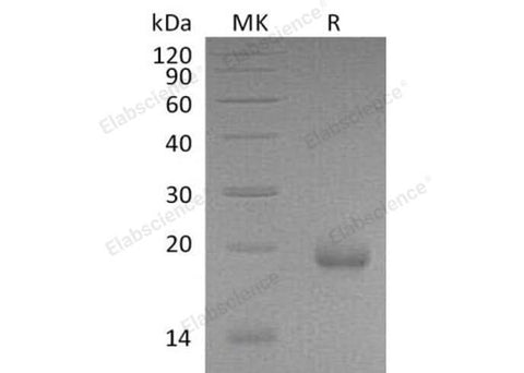 Recombinant Mouse IFN-zeta/Limitin Protein (His Tag) - ABMIUM