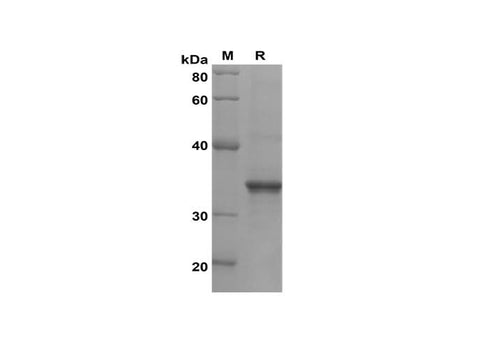 SDS-PAGE analysis of Mouse CCL25/TECK proteins, 2 μg/lane of Recombinant Mouse CCL25/TECK proteins was resolved with SDS-PAGE under reducing conditions, showing bands at 35 kDa.