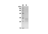 SDS-PAGE analysis of Human TDGF1 proteins, 2 μg/lane of Recombinant Human TDGF1 proteins was resolved with SDS-PAGE under reducing conditions, showing bands at 20-30 kDa.