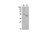 SDS-PAGE analysis of Human Apolipoprotein E/ApoE proteins, 2 μg/lane of Recombinant Human Apolipoprotein E/ApoE proteins was resolved with SDS-PAGE under reducing conditions, showing bands at 36 kDa.