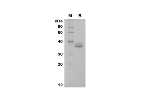 SDS-PAGE analysis of Human Apolipoprotein E/ApoE proteins, 2 μg/lane of Recombinant Human Apolipoprotein E/ApoE proteins was resolved with SDS-PAGE under reducing conditions, showing bands at 36 kDa.