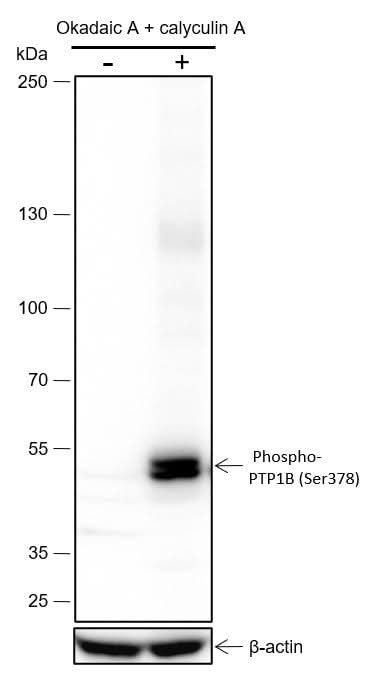 Anti-Human Phospho-PTP1B (Ser378) Antibody [A805] - ABMIUM