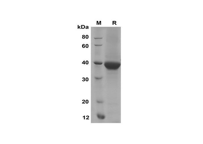 SDS-PAGE analysis of Human GREM1 proteins, 2 μg/lane of Recombinant Human GREM1 proteins was resolved with SDS-PAGE under reducing conditions, showing bands at 40 kDa.