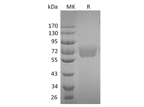 Recombinant Human IL4RA/CD124 Protein (Fc Tag) - ABMIUM