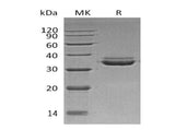 Recombinant Human LMAN2L Protein (His Tag) - ABMIUM