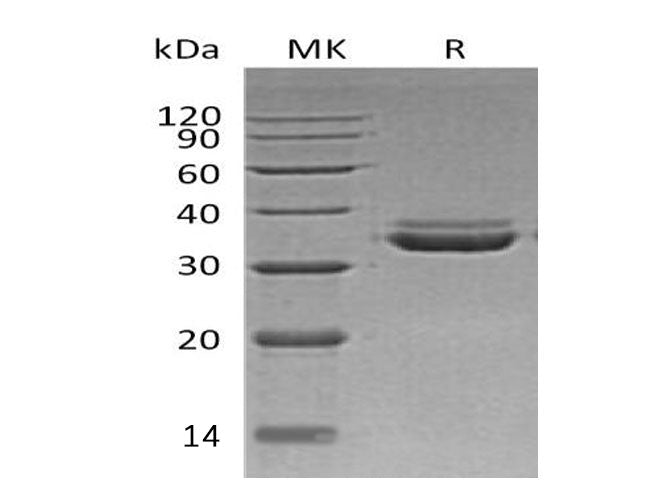 Recombinant Human LMAN2L Protein (His Tag) - ABMIUM