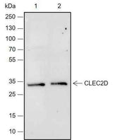 Anti-Human CLEC2D Antibody [A686]