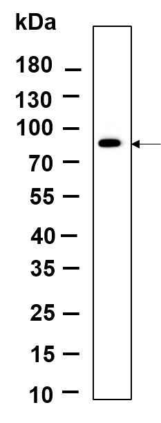Anti-Human IRAK-1 Antibody [B933] - ABMIUM